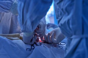Apendicectomía por laparoscopia para endometriosis apendicular