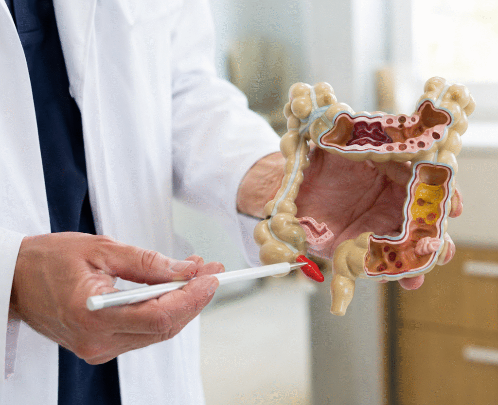 Especialista en Proctología mostrando un modelo anatómico del colon y recto
