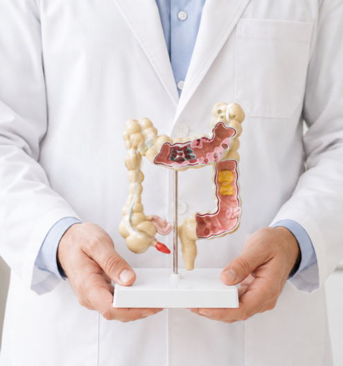 Especialista en proctología con modelo anatómico de colon y recto